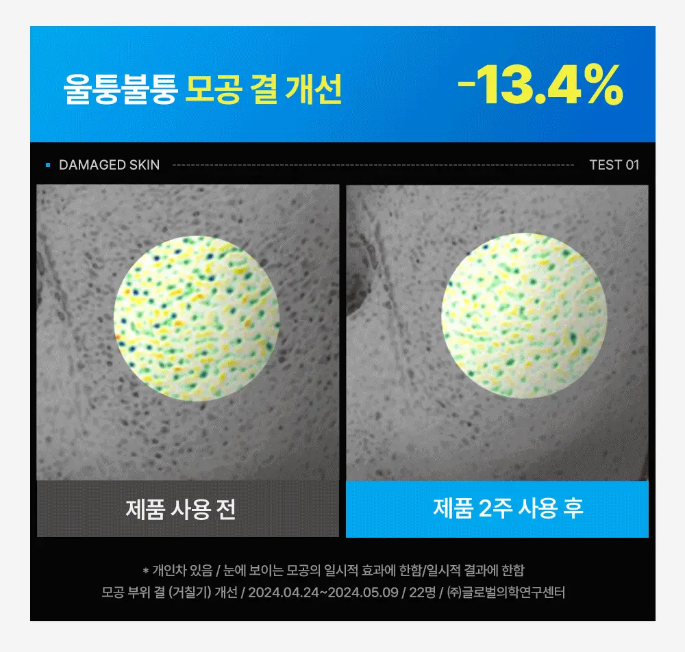 [모공밴딩크림] 웰라쥬 하이퍼 펩타이드 밴디지 크림 50ml 상세페이지 15